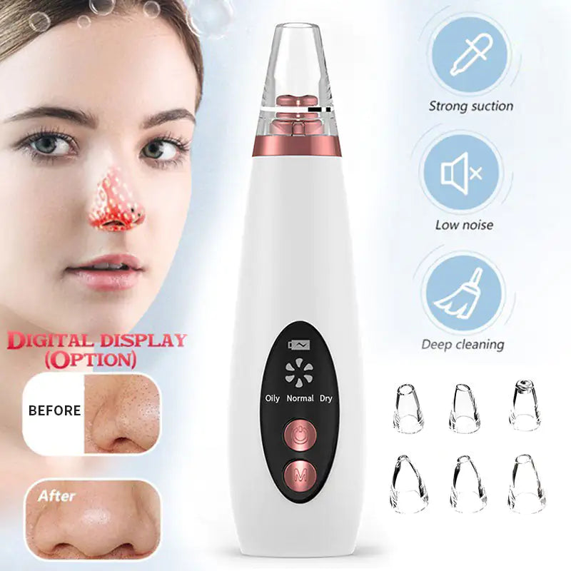 The Ultimate Blackhead Remover