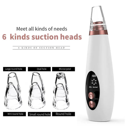 The Ultimate Blackhead Remover