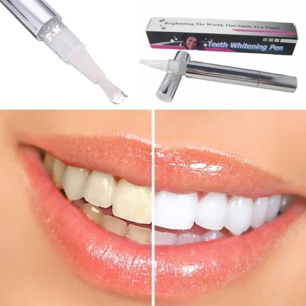 Ultimate Stain Removing Pen